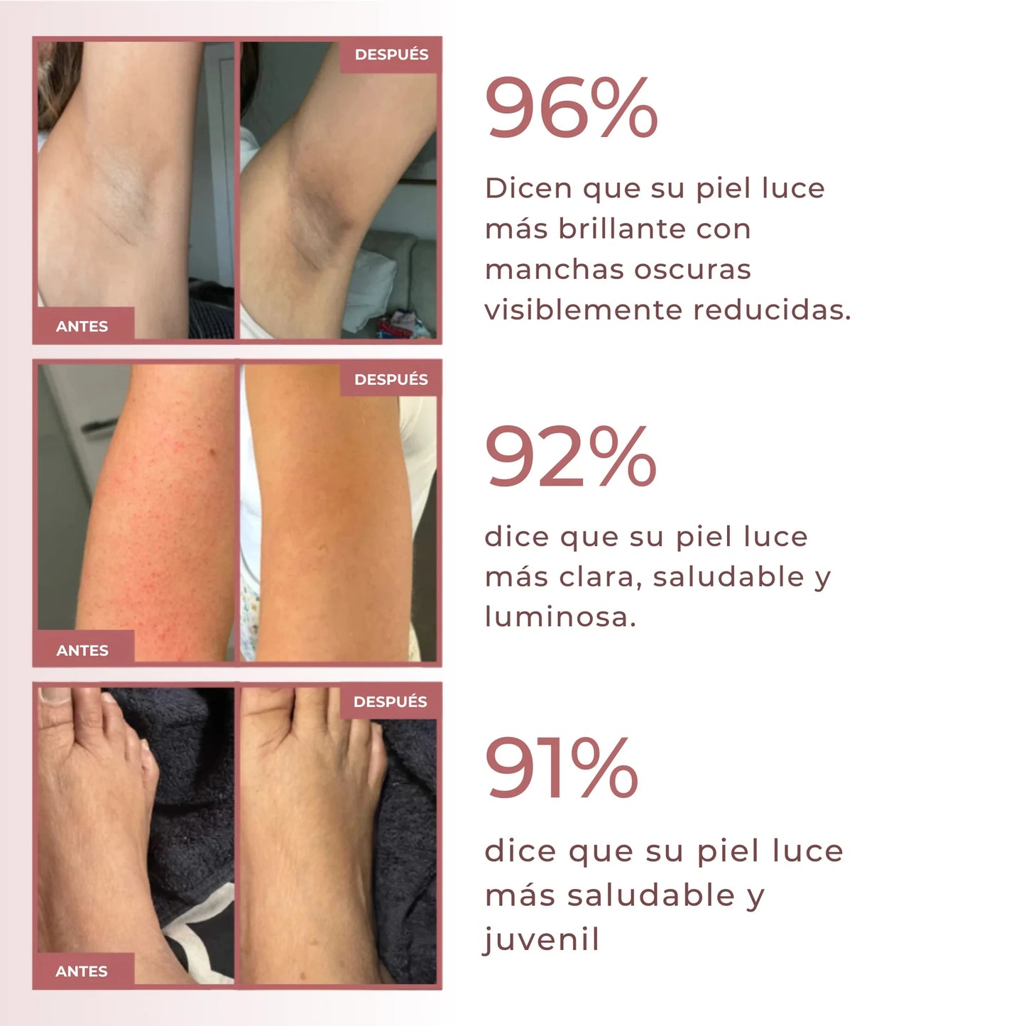 Spray exfoliante corporal - Kójico + Cúrcuma