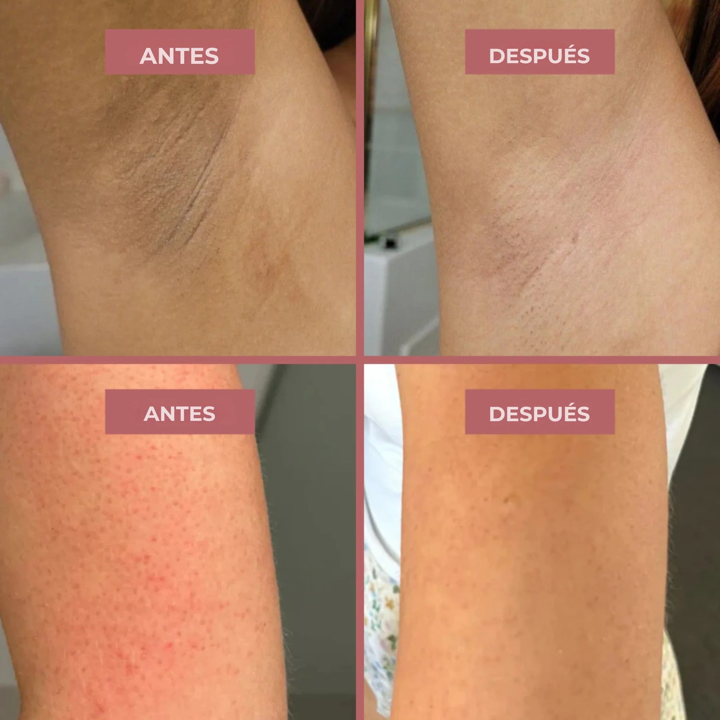 Spray exfoliante corporal - Kójico + Cúrcuma