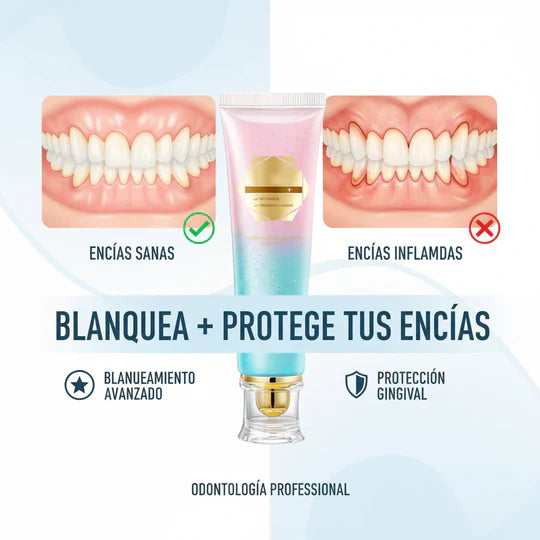 Bodison Soap®-Pasta Dental Blanqueadora con Niacinamida- 2 X 1